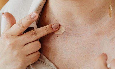 Ar fort�ller historier: N�r huden b�rer minderne, men du �nsker at d�mpe dem