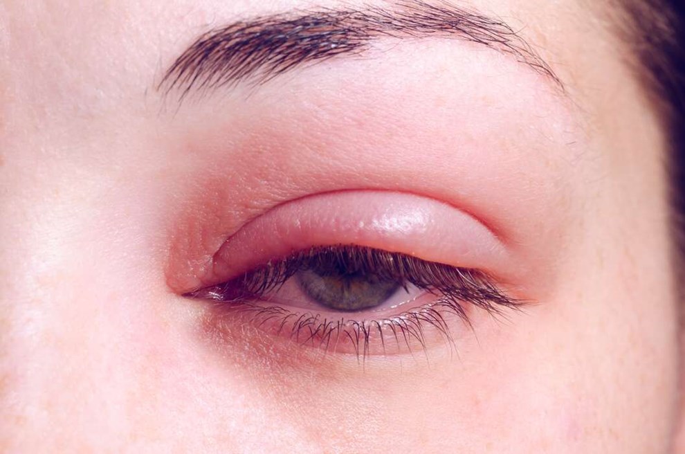 Sdan finder du ud af, om du har bygkorn