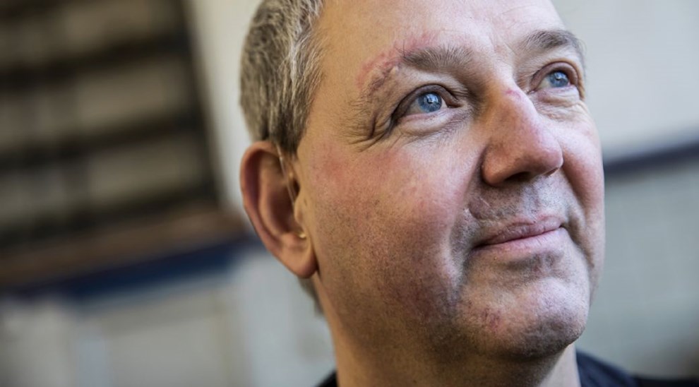 Torben skulle pr�ve vennernes el-l�behjul: 'Jeg kan bare huske, at jeg lander p� ansigtet, og s� bliver det sort'