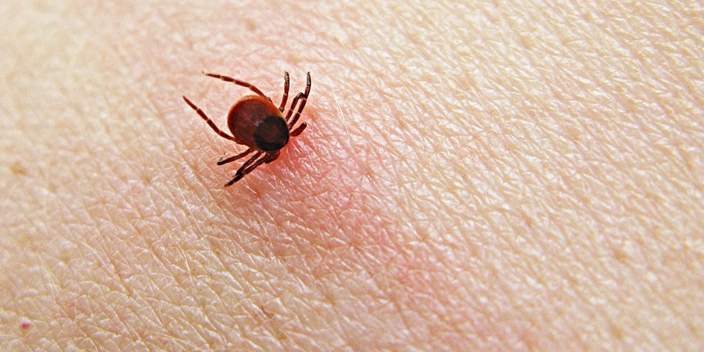 S�dan st�r det til med smitten p� Bornholm